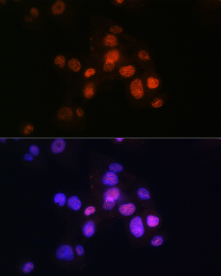 HNF3B Beta/FOXA2 Rabbit monoclonal antibody