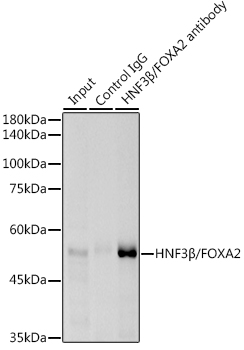 HNF3B Beta/FOXA2 Rabbit monoclonal antibody