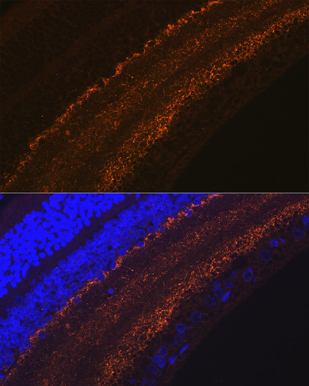 GAP43 Rabbit monoclonal antibody