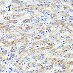 Western blot - Glucosylceramidase beta (GBA) Rabbit mAb (A19057)