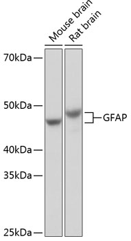 GFAP Rabbit monoclonal antibody