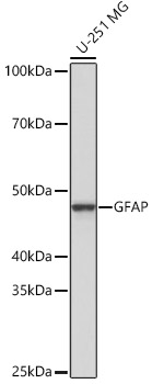 GFAP Rabbit monoclonal antibody