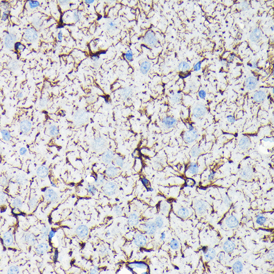 GFAP Rabbit monoclonal antibody