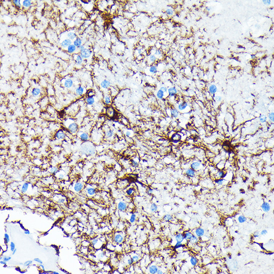 GFAP Rabbit monoclonal antibody