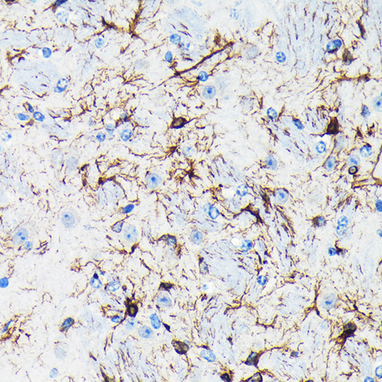 GFAP Rabbit monoclonal antibody