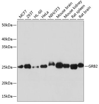 GRB2 Rabbit monoclonal antibody