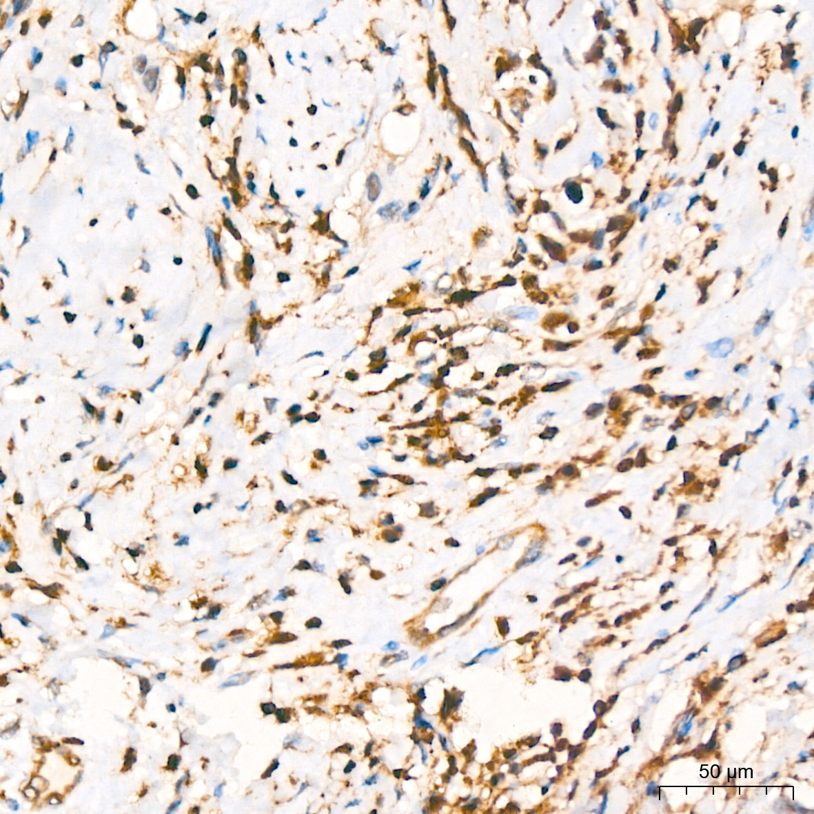 GRB2 Rabbit monoclonal antibody
