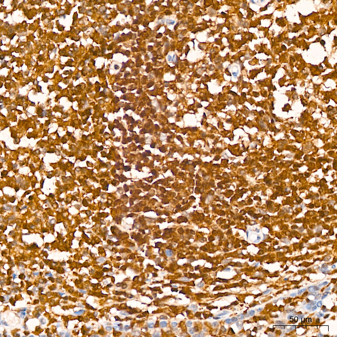 GRB2 Rabbit monoclonal antibody