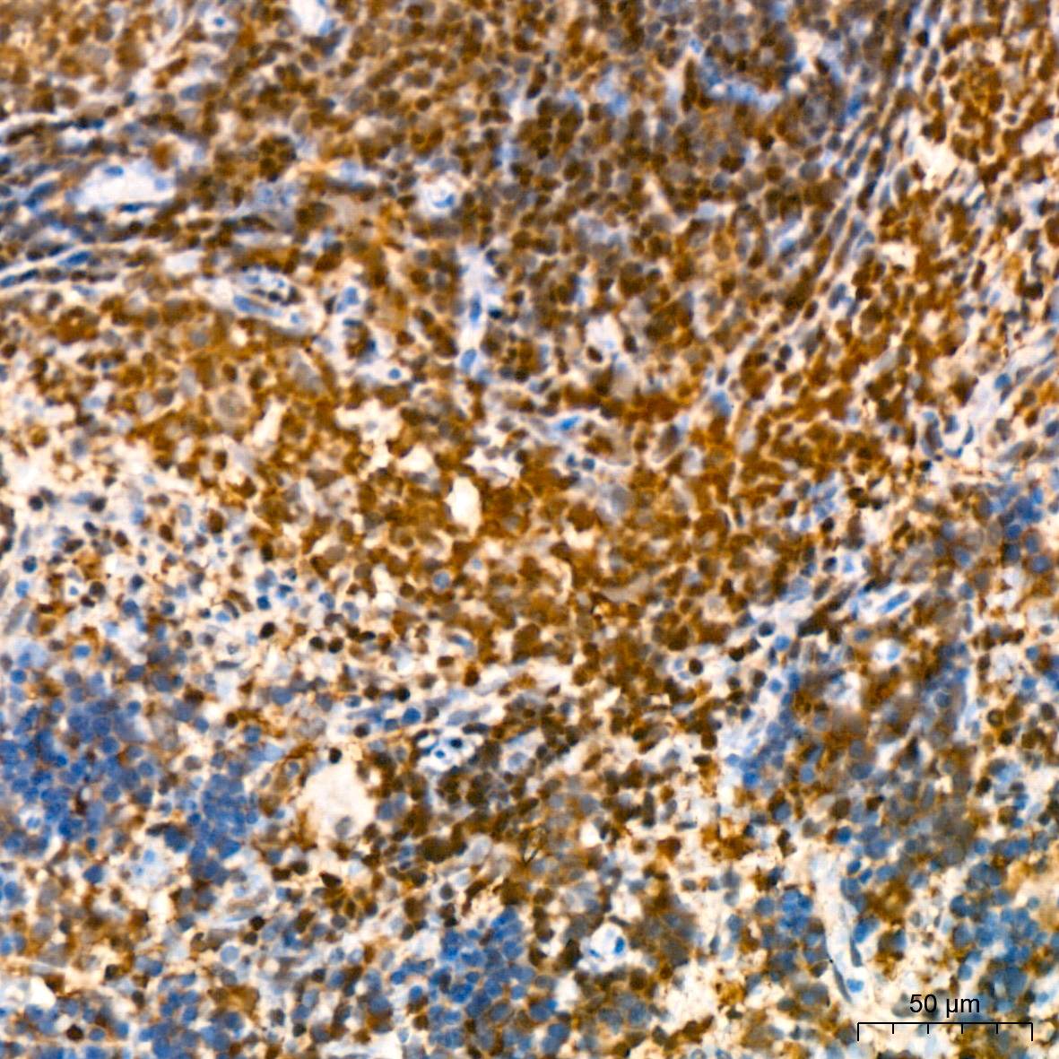 GRB2 Rabbit monoclonal antibody