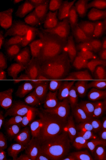 PADI4 Rabbit polyclonal antibody