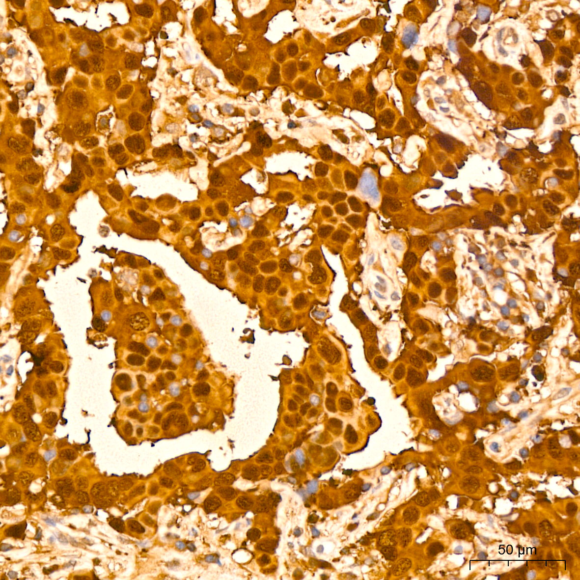 GST3/GSTP1 Rabbit monoclonal antibody