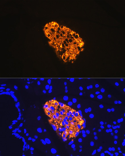 Insulin Rabbit monoclonal antibody