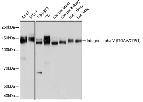 Integrin alpha V (ITGAV/CD51) Rabbit monoclonal antibody