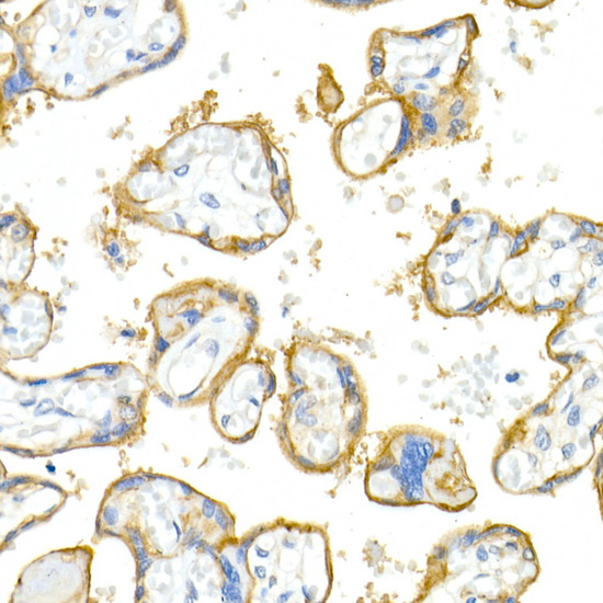 Integrin alpha V (ITGAV/CD51) Rabbit monoclonal antibody
