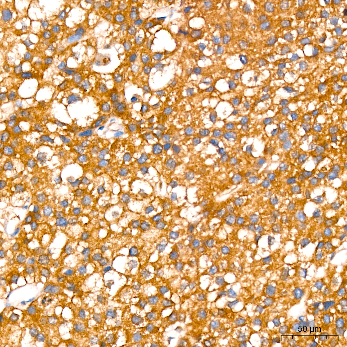 Leptin Receptor Rabbit monoclonal antibody
