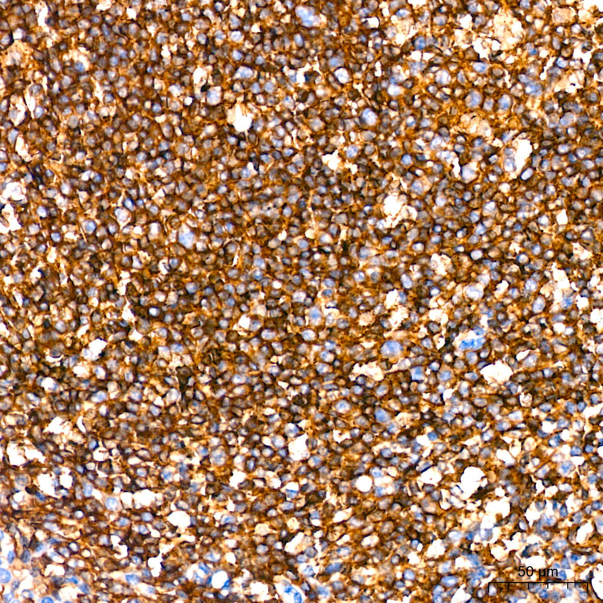 Leptin Receptor Rabbit monoclonal antibody