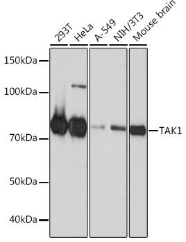 [KO Validated] TAK1 Rabbit monoclonal antibody