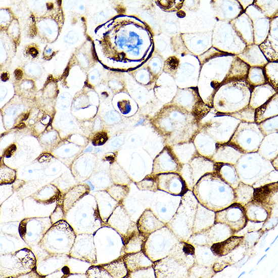 MUC1-C Rabbit monoclonal antibody