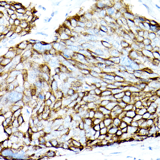 MUC1-C Rabbit monoclonal antibody