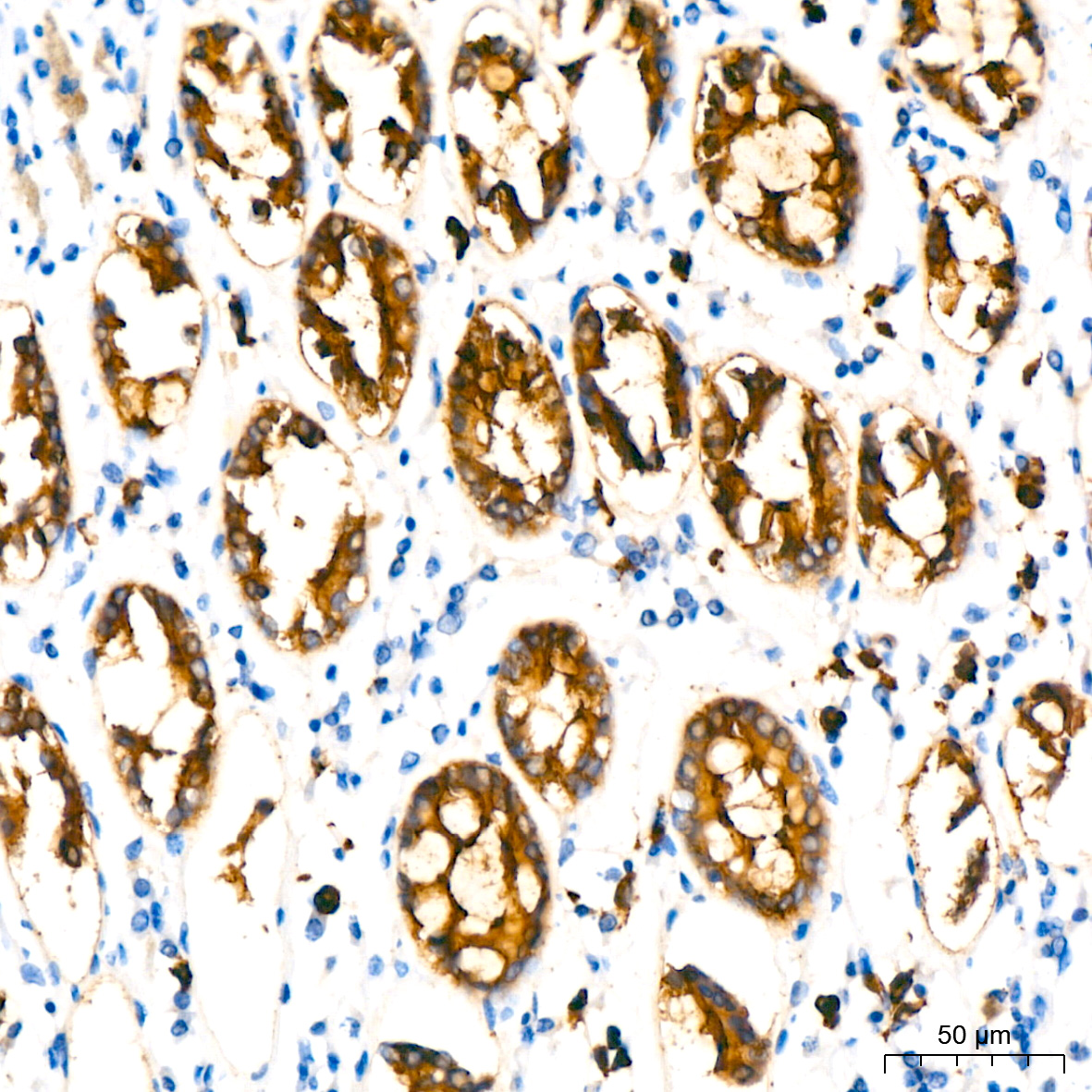 MUC1-C Rabbit monoclonal antibody
