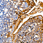 Western blot - MUC1 Rabbit mAb (A19081)
