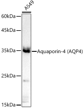 [KO Validated] MyD88 Rabbit monoclonal antibody