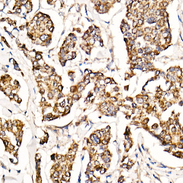 [KO Validated] MyD88 Rabbit monoclonal antibody