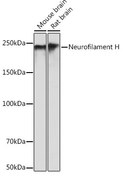 Neurofilament H Rabbit monoclonal antibody