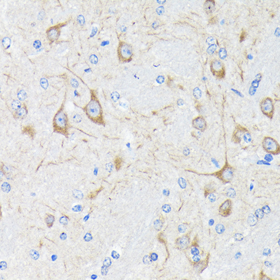 Neurofilament H Rabbit monoclonal antibody