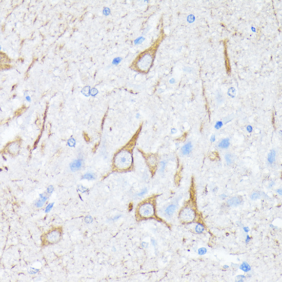 Neurofilament H Rabbit monoclonal antibody