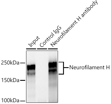 Neurofilament H Rabbit monoclonal antibody