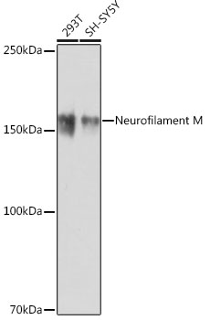 Neurofilament M Rabbit monoclonal antibody