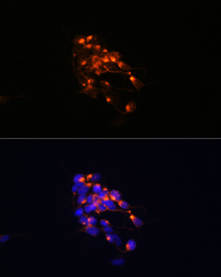 Neurofilament M Rabbit monoclonal antibody