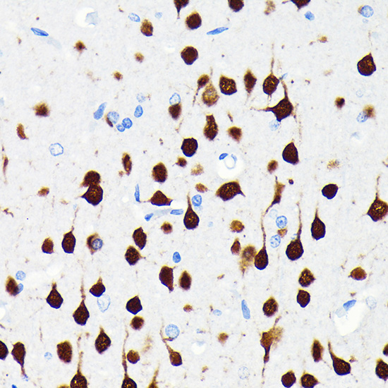 NeuN Rabbit monoclonal antibody