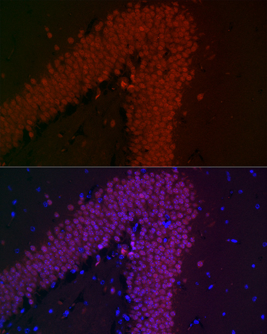 NeuN Rabbit monoclonal antibody