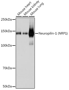 Neuropilin-1 (NRP1) Rabbit monoclonal antibody