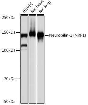 Neuropilin-1 (NRP1) Rabbit monoclonal antibody