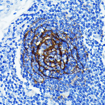 p75NTR/NGFR Rabbit monoclonal antibody