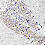 Western blot - NMDAR2A Rabbit mAb (A19089)