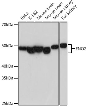 ENO2 Rabbit monoclonal antibody