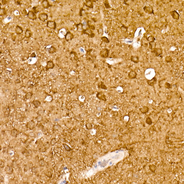 ENO2 Rabbit monoclonal antibody