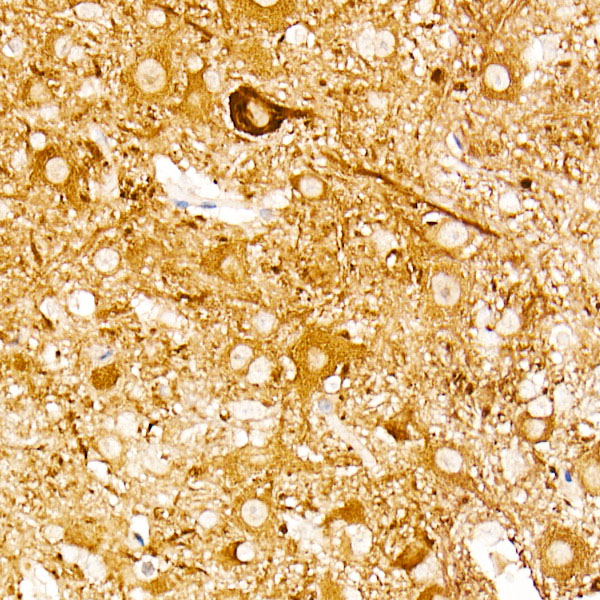 ENO2 Rabbit monoclonal antibody