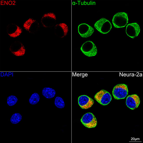 ENO2 Rabbit monoclonal antibody