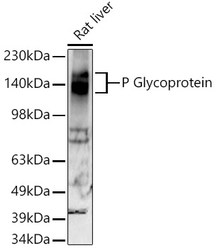 [KO Validated] P Glycoprotein Rabbit monoclonal antibody