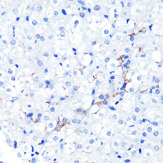 [KO Validated] P Glycoprotein Rabbit monoclonal antibody