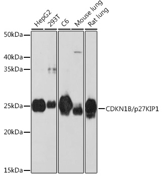 [KO Validated] CDKN1B/p27KIP1 Rabbit monoclonal antibody