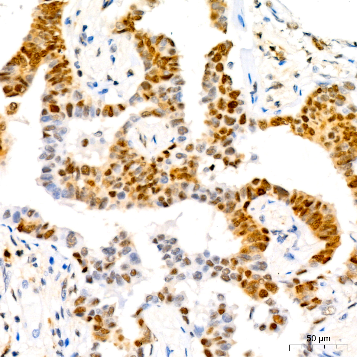 [KO Validated] CDKN1B/p27KIP1 Rabbit monoclonal antibody
