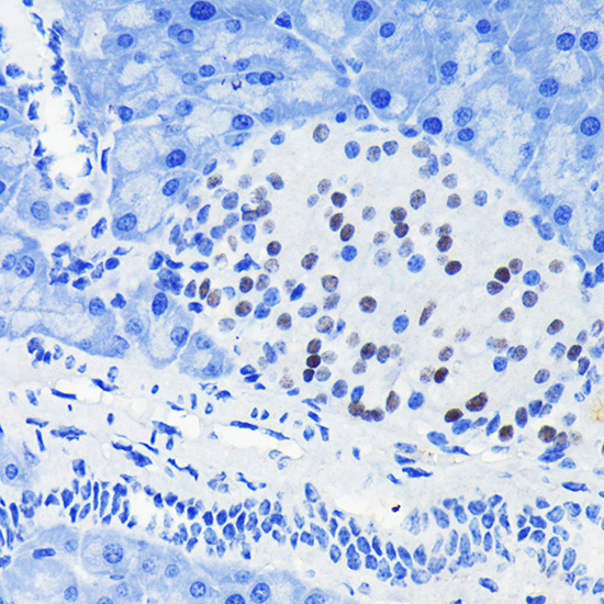 PAX6 Rabbit monoclonal antibody
