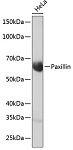 Western blot - Paxillin Rabbit mAb (A19100)