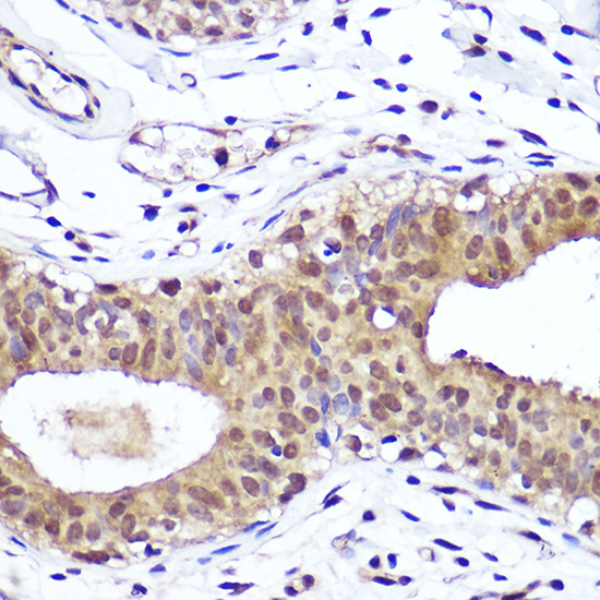 [KO Validated] PTEN Rabbit monoclonal antibody
